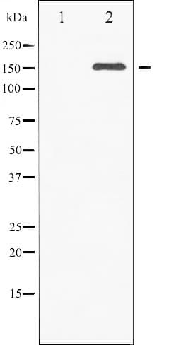 Polyclonal Rabbit anti-Human c-Met Antibody (phospho-Tyr1003, IHC, IF, WB)