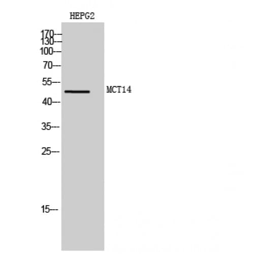SLC16A14 / MCT14 Antibody (100-180 aa, Internal)