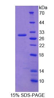 Human RRBP1 / hES Protein (Recombinant His, N-Terminal)