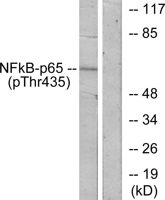 RELA / NFKB p65 Antibody (phospho-Thr435)