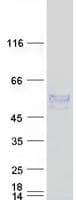 Human ENPP6 Protein (Recombinant Myc-DDK (Flag))