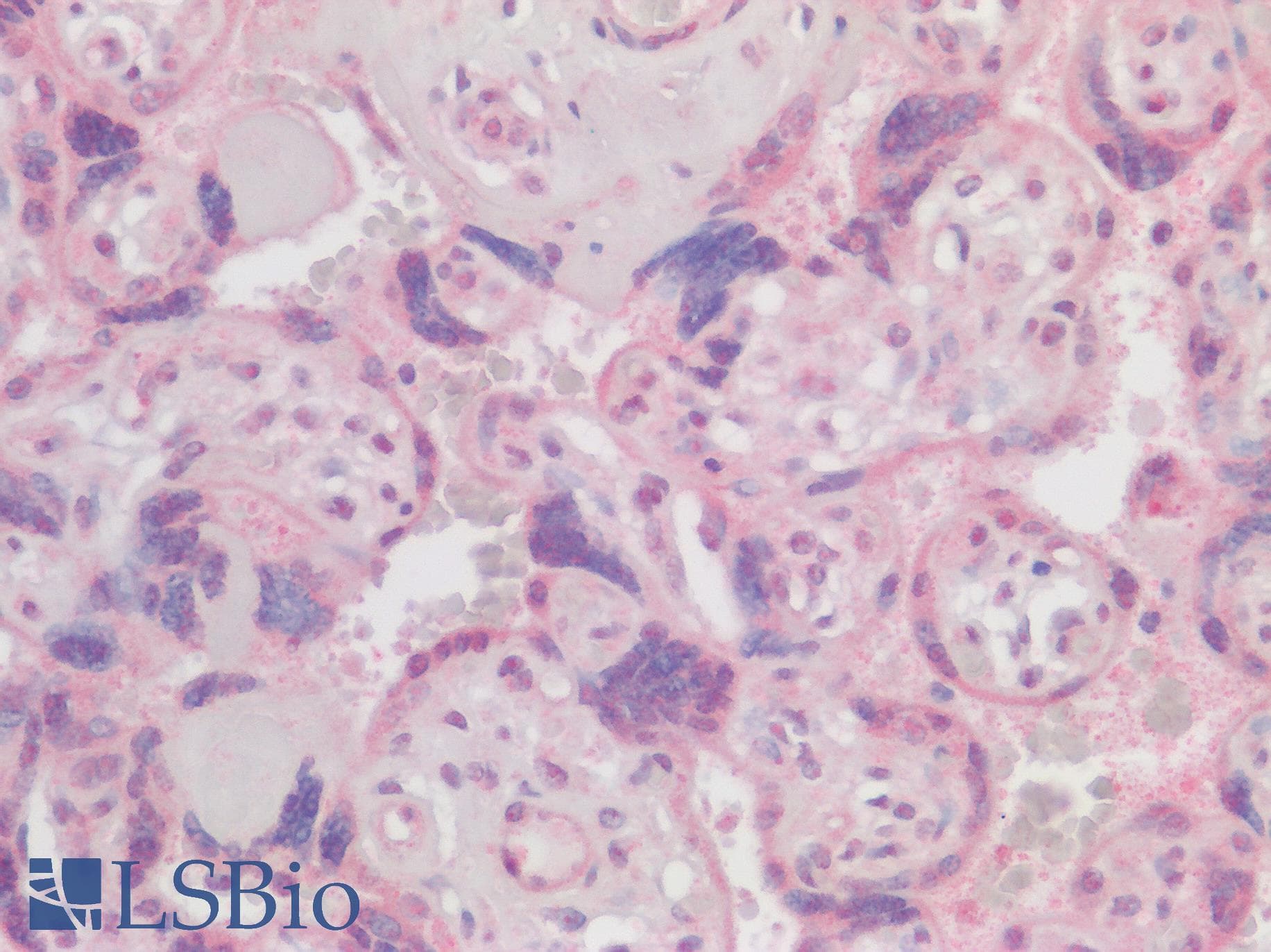 IHC-plus™ Polyclonal Rabbit anti-Human DKK1 Antibody (Internal Region, IHC, WB)