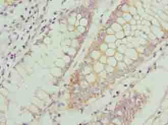CCR1 Antibody