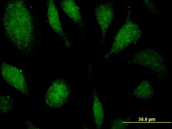 EEF1D Antibody (clone 4B12)