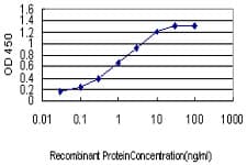 Monoclonal Mouse anti-Human PDK3 Antibody (clone 2B11, WB)