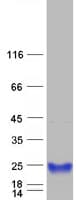 Human RBP4 Protein (Recombinant Myc-DDK (Flag))