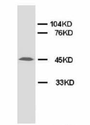 AGER / RAGE Antibody (N-Terminus)