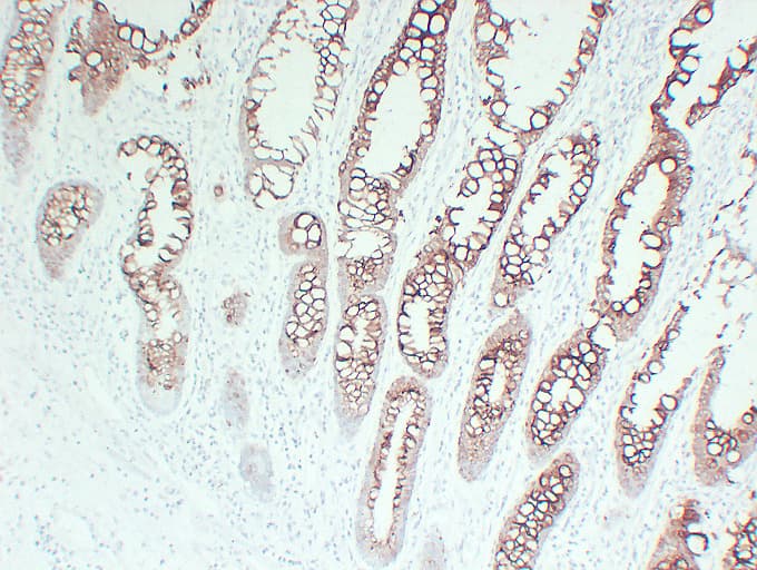 KRT20 / CK20 / Cytokeratin 20 Antibody (clone ABT-Ck20)