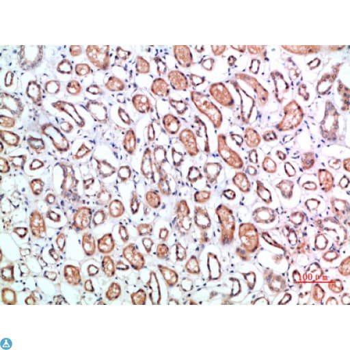 CD1B Antibody