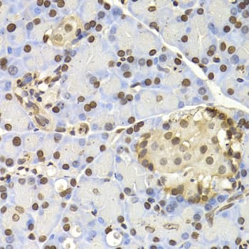 Polyclonal Rabbit anti-Human NAP1L1 Antibody (IHC, WB)