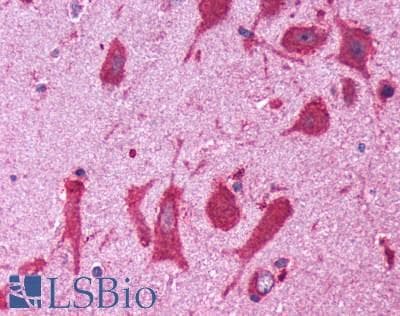 PathPlus™ Polyclonal Rabbit anti-Human CNR1 / CB1 Antibody (Cytoplasmic Domain, IHC)