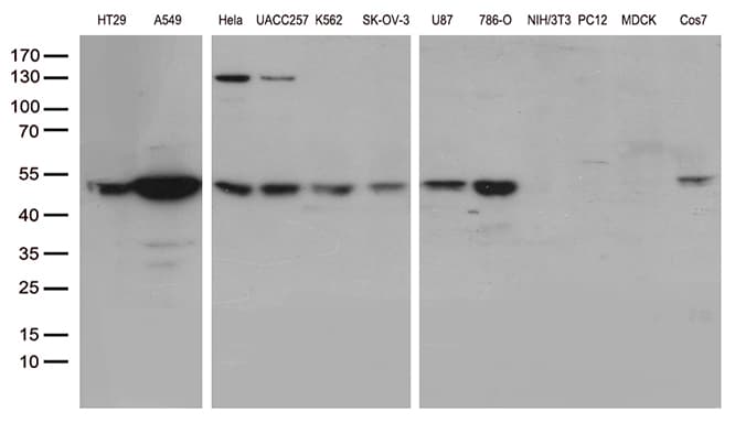 Monoclonal Mouse anti-Human UBA3 / UBE1C Antibody (clone OTI7H6, aa1-463, IHC, WB)