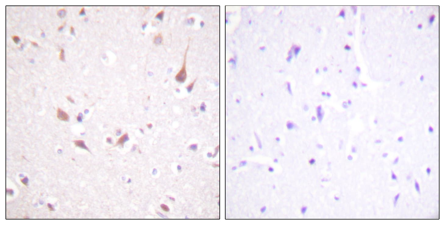 Polyclonal Rabbit anti-Human MST1 + MST2 Antibody (aa149-198, IHC, WB)