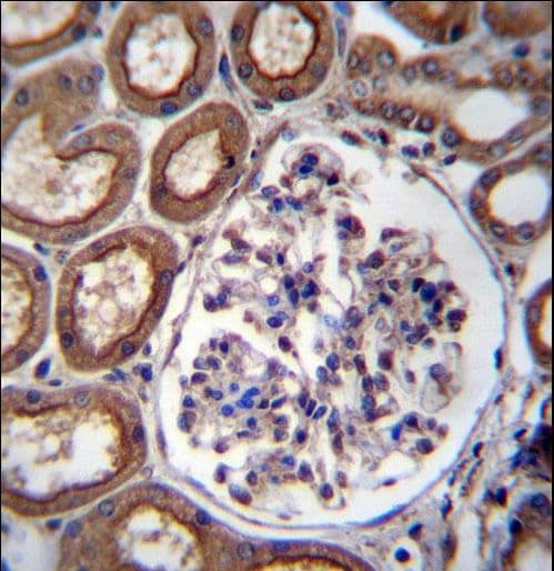 PLS1 / Fimbrin Antibody (aa550-579)