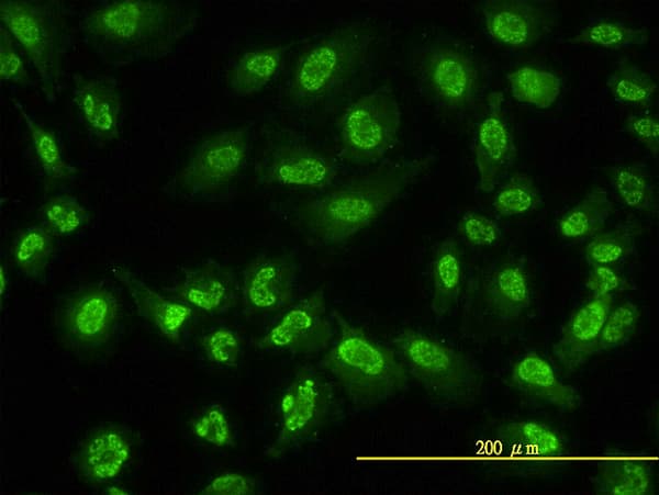 Monoclonal Mouse anti-Human ACD / PTOP Antibody (clone 1D8-1B6, IHC, IF, WB)