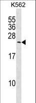 MYL6B Antibody (aa96-123)