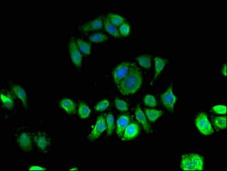 QIP1 / KPNA4 Antibody