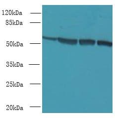 CCDC112 / MBC1 Antibody (Coiled-coil domain)