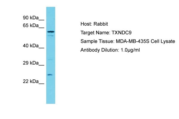 TXNDC9 Antibody (N-Terminus)