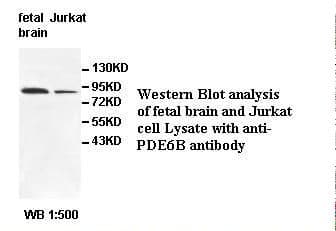 PDE6B / PDE6 Beta Antibody