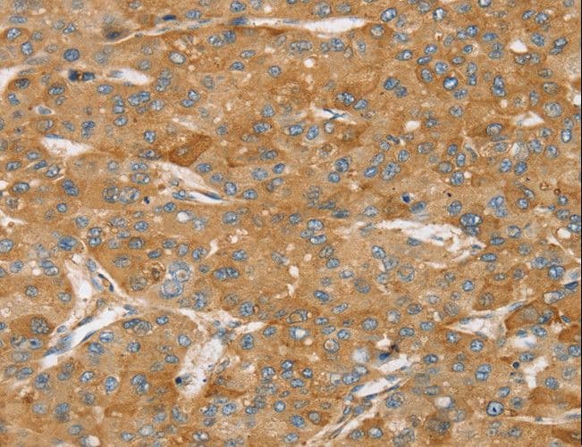 TPD52L2 / HD54 Antibody