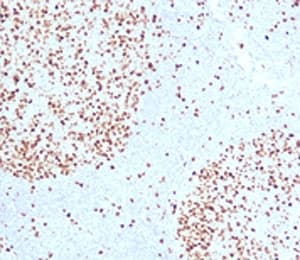 TOP2A / Topoisomerase II Alpha Antibody (clone TPM2A-1)
