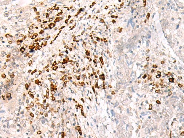 HLA-B Antibody