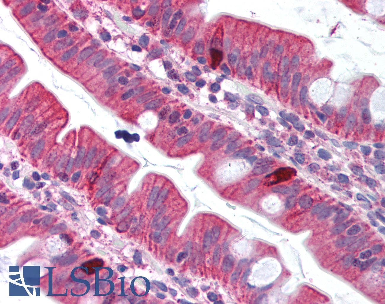 IHC-plus™ TNFSF11 / RANKL / TRANCE Antibody