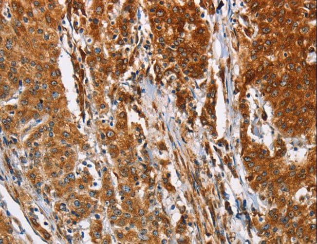 BCAP31 / BAP31 Antibody