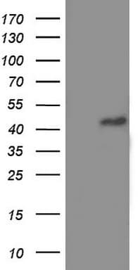 TRIM54 / MURF Antibody (aa166-400, clone OTI2A11)