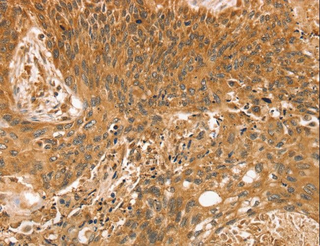 STX10 / Syntaxin 10 Antibody
