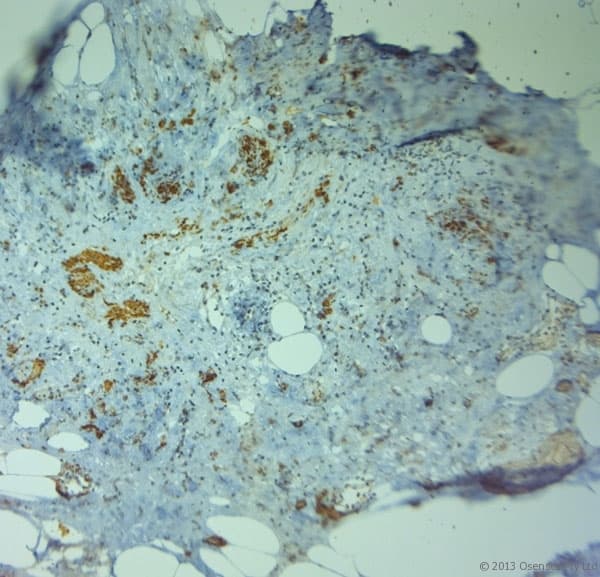 TJP2 / ZO2 / ZO-2 Antibody (aa740-790)