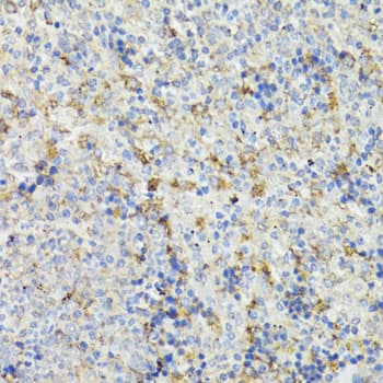 CHGA / Chromogranin A Antibody
