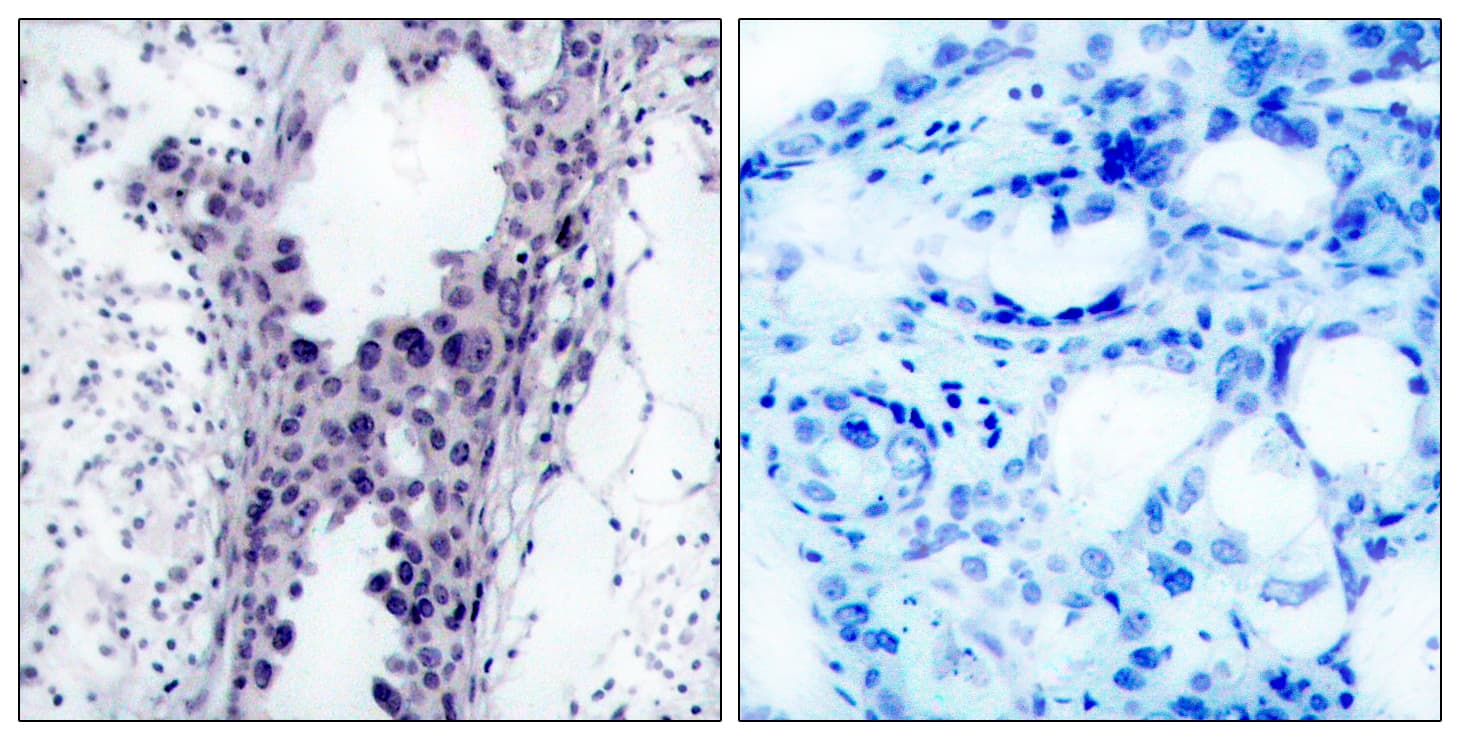 PTEN Antibody (C-Terminus)