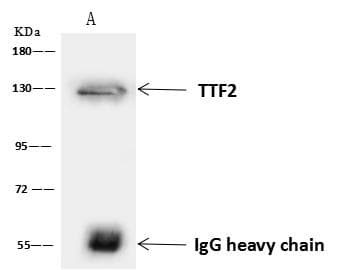 TTF2 / HuF2 Antibody