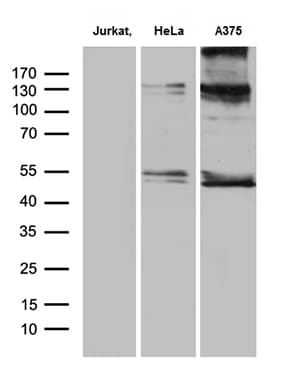 NFKBIE / IKB Epsilon Antibody (clone OTI6H8)
