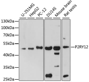 Polyclonal Rabbit anti-Human P2RY12 / P2Y12 Antibody (WB)