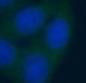 NAMPT / Visfatin Antibody