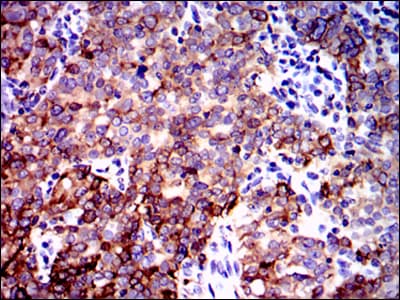 PPP2R4 Antibody (clone 4D9)