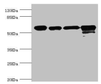 CCT2 / CCT Beta Antibody