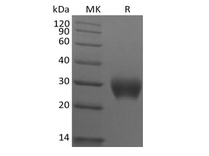 Rhesus monkey LAIR1 / CD305 Protein (Recombinant 6His, C-terminus)