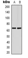 EEYORE / TIGD1 Antibody (Internal)