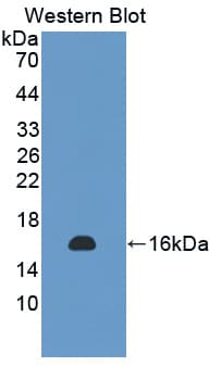 SPECC1 / CYTSB Antibody (aa961-1063)
