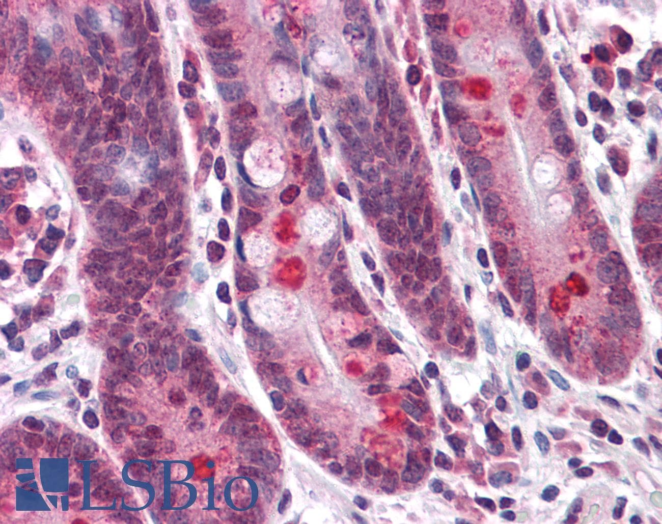 Polyclonal Rabbit anti-Human TMEM16B / ANO2 Antibody (IHC, IF, WB)