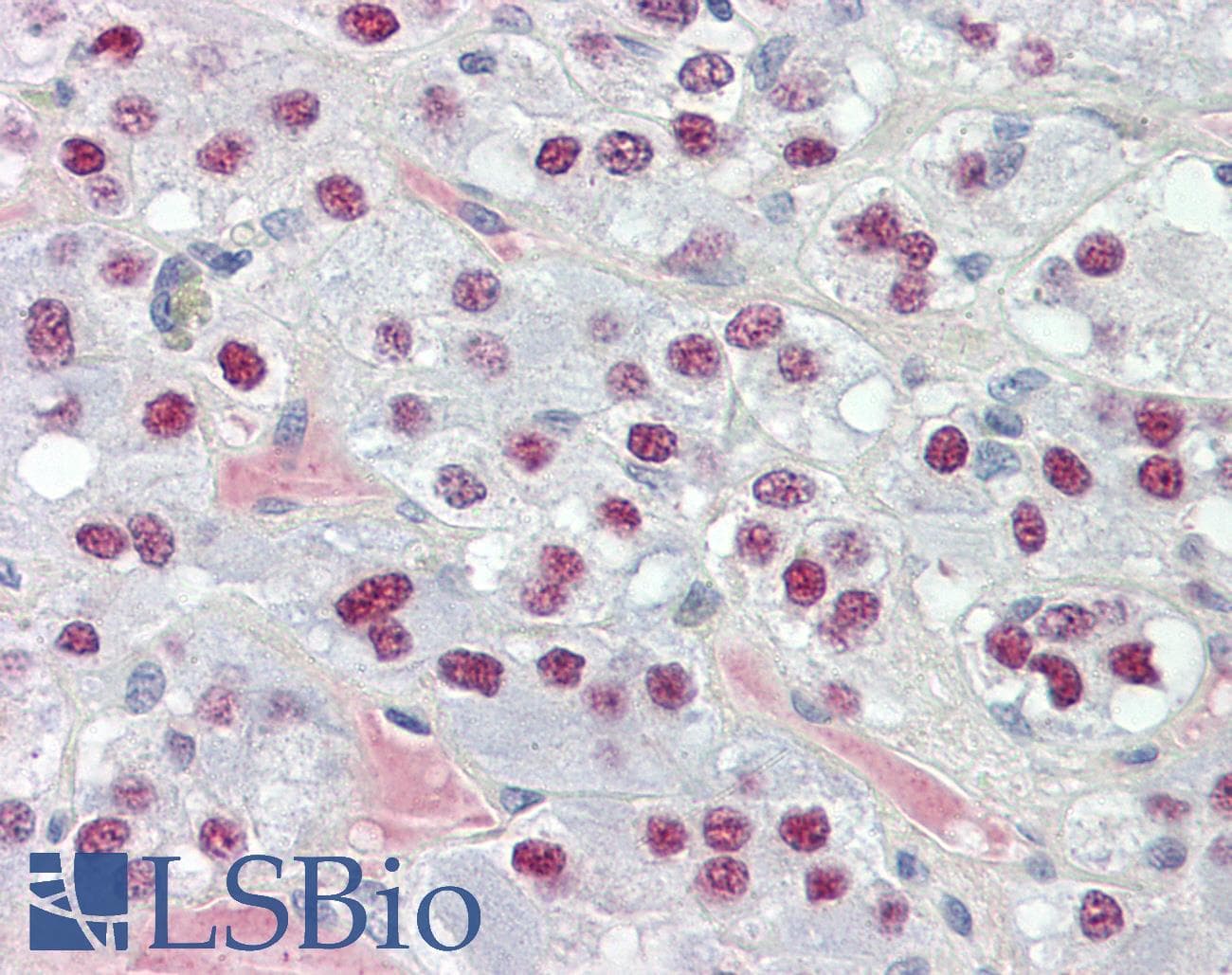 IHC-plus™ TCEAL3+5+6 Antibody (aa141-190)