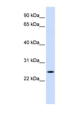 Polyclonal Rabbit anti-Human NOL3 / ARC Antibody (C-Terminus, WB)