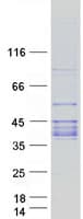 Human ABO Glycosyltransferase Protein (Recombinant Myc-DDK (Flag))