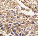 ARSB / Arylsulfatase B Antibody (aa464-493)