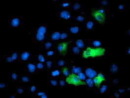 ANAPC2 / APC2 Antibody (clone OTI2A1)