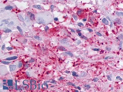 PathPlus™ LPAR5 / GPR92 Antibody (Cytoplasmic Domain)